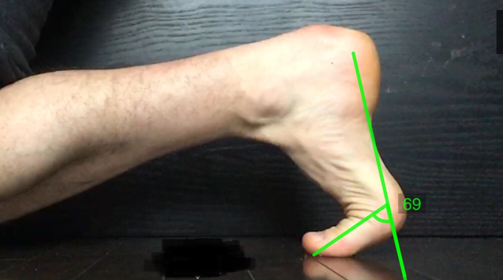Why Is The Big Toe So Important For Runners? Matthew Boyd Physio
