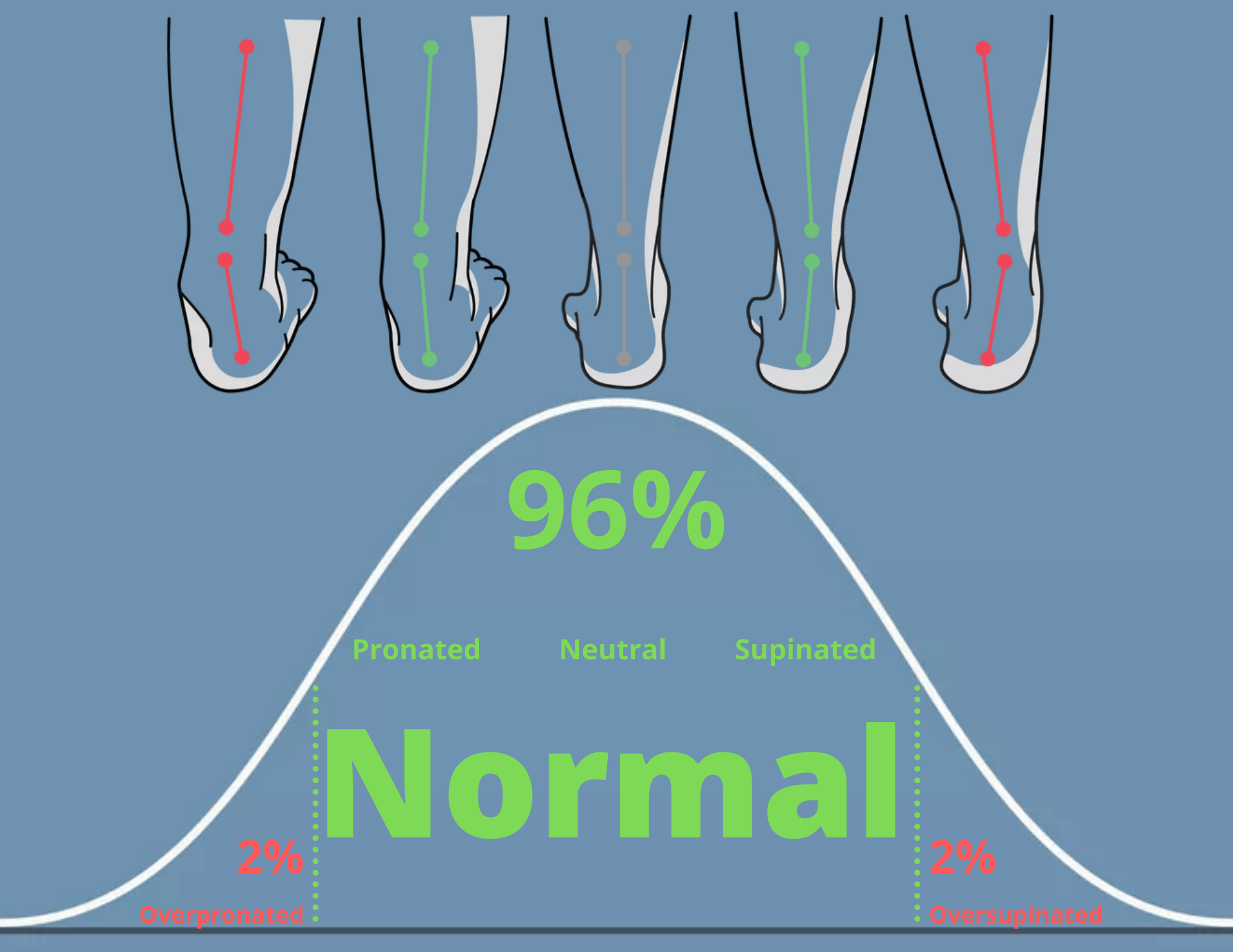 Does Pronation cause Running Injuries? Matthew Boyd Physio