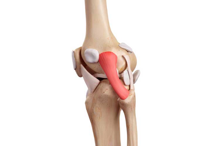 LCL Repair Posterolateral Corner Reconstruction Vail, Aspen