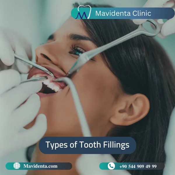 Tooth Filling Cost In Turkey Treatment Cost And Information