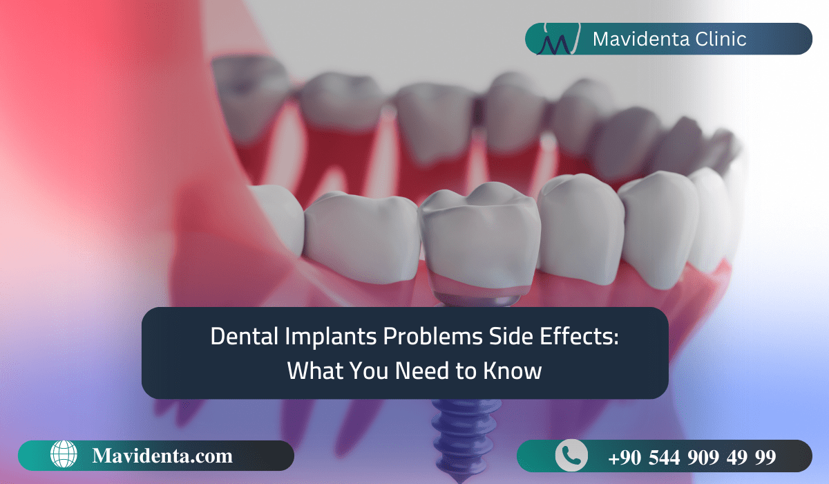 Dental Implants Problems Side Effects What You Need To Know