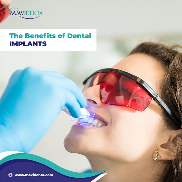 What Is The Best Country For Dental Implants?