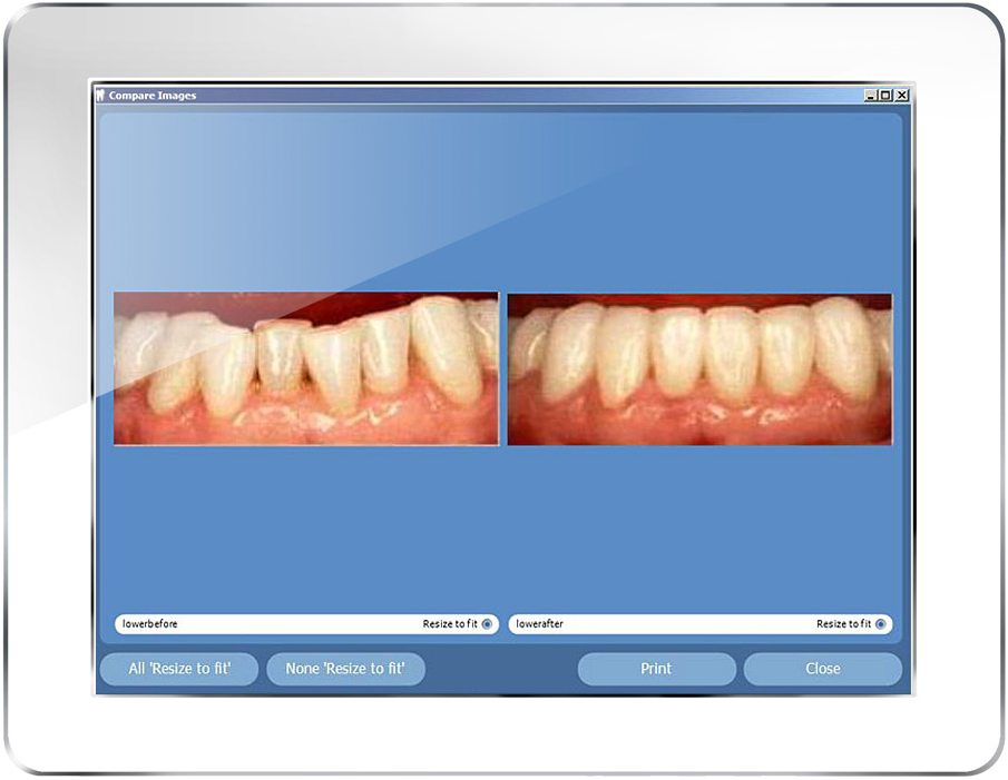 Dental Digital Imaging Software