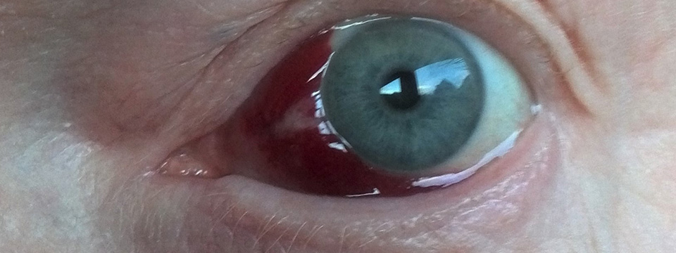 Een Rood Oog Kan Geen Kwaad - Max Magazine