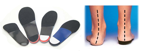 Richmond Hill Custom Orthotics