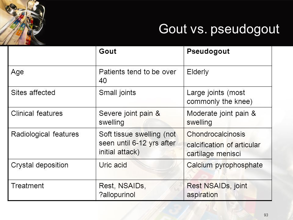 Gout vs Pseudogout Risk Factors,Causes, and Symptoms Mayflax