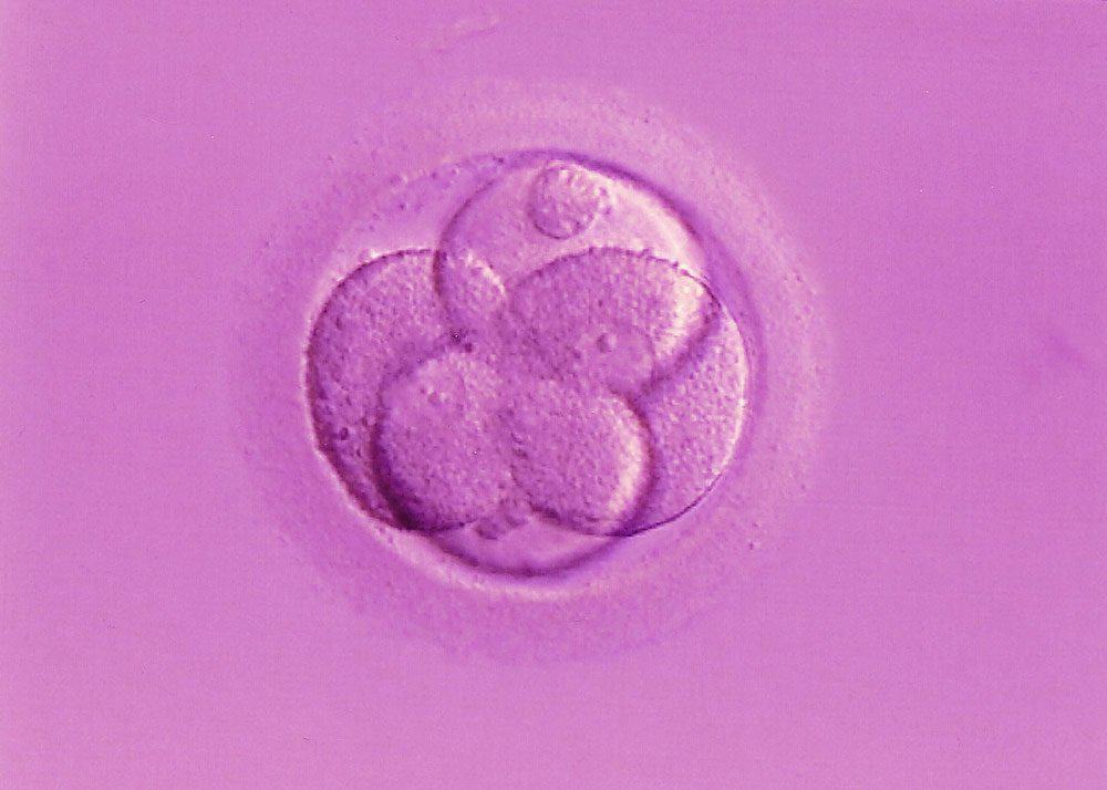 Missouri appeals court considers the rights of frozen human embryos