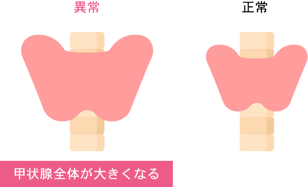 甲状腺のクリニック｜名古屋市名東区｜メディカルケア内科