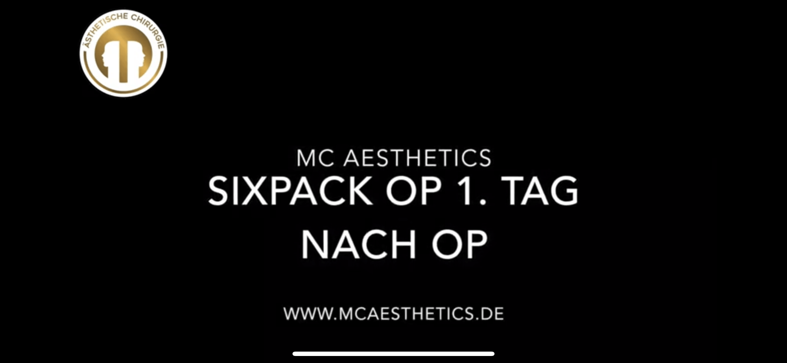 Sixpack Op vorher nachher Ergebnis Mc Aesthetics in Köln