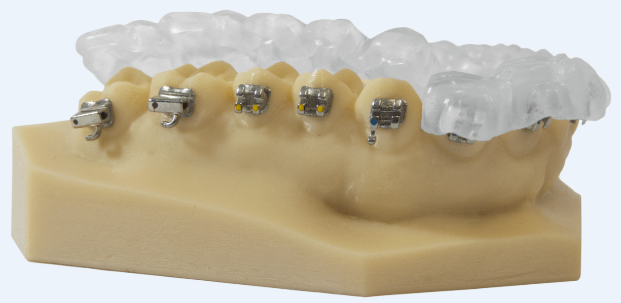 NextDent Ortho IBT MCF Solutions