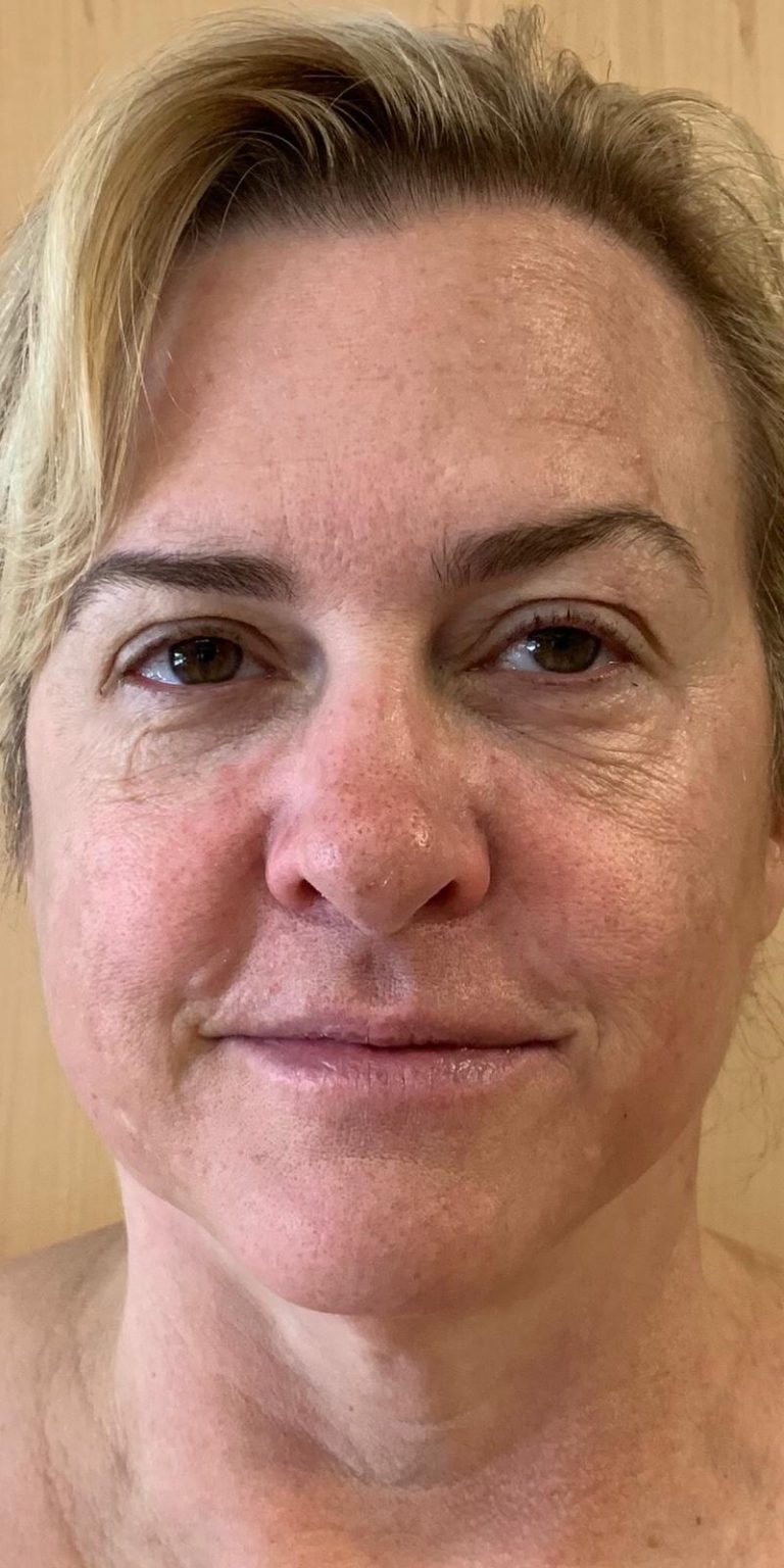 Functional Medicine skin care Atlanta Functional skin spa