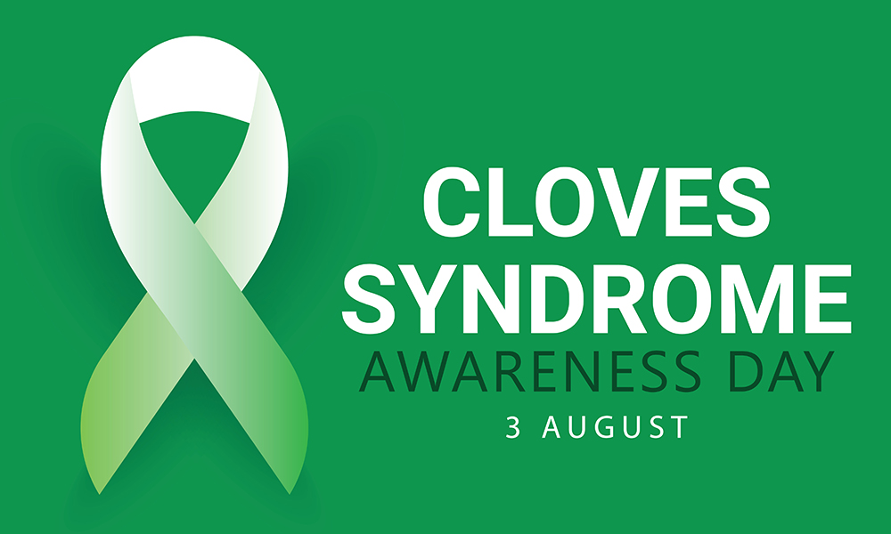 Raising Awareness Cloves Syndrome Awareness Day MCR Health