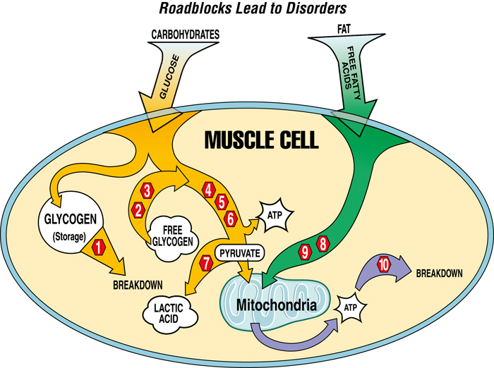 Types of Metabolic Diseases of Muscle Metabolic Diseases of Muscle MDA