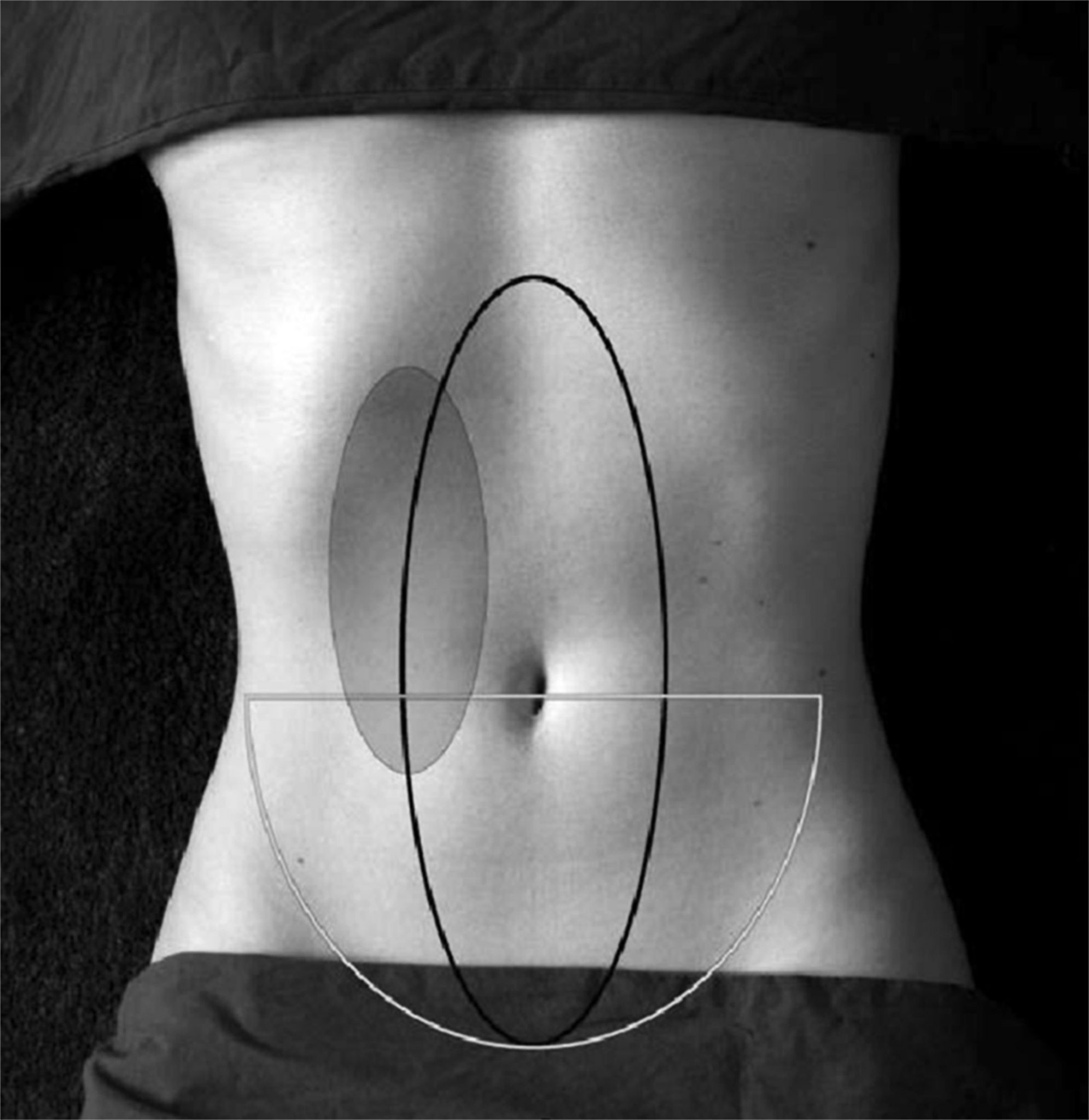 Regional Anesthesia For Abdominal Surgery Healthcare and Medical News for Atlanta Physicians