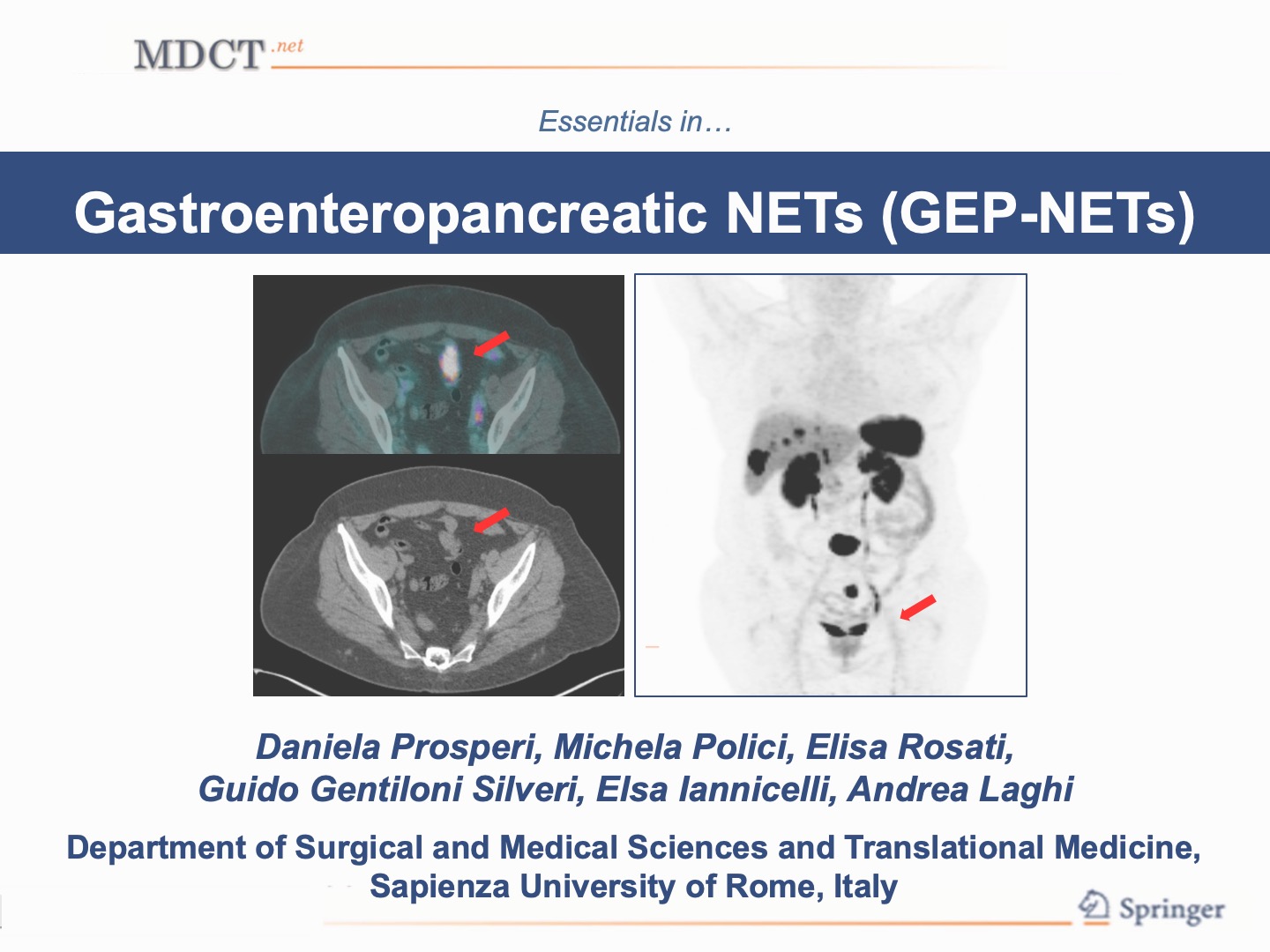 Gastroenteropancreatic NETs