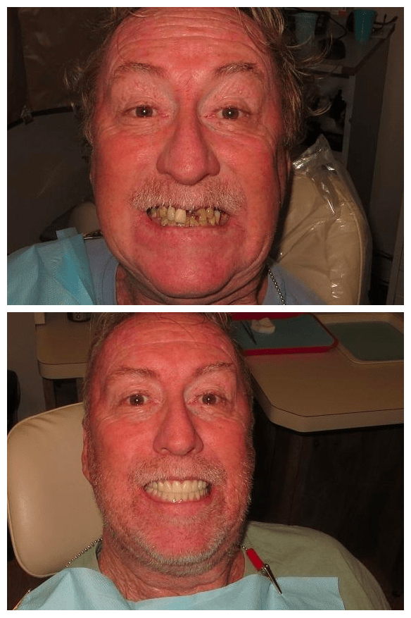 Matthew Lasorsa, DMD Mini Dental Implant Centers of America MDICA