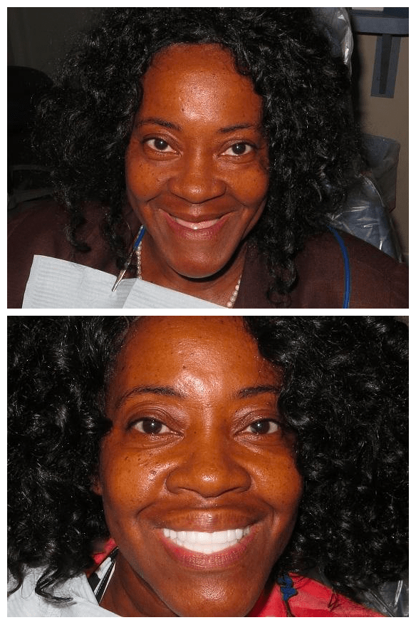 Matthew Lasorsa, DMD Mini Dental Implant Centers of America MDICA