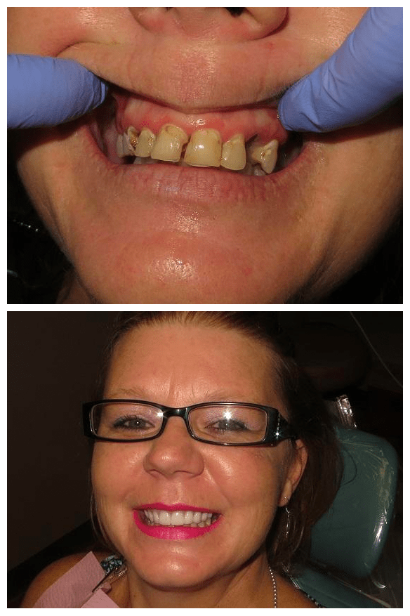 Matthew Lasorsa, DMD Mini Dental Implant Centers of America MDICA