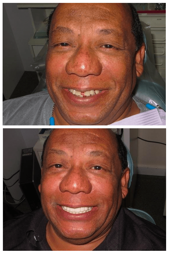 Matthew Lasorsa, DMD Mini Dental Implant Centers of America MDICA