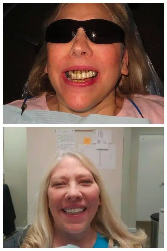 Matthew Lasorsa, DMD Mini Dental Implant Centers of America