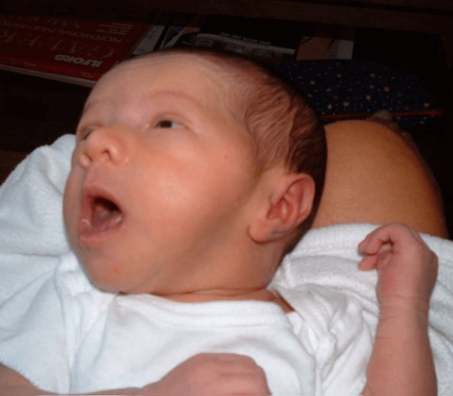 Hunger Cues MD Pediatric Associates