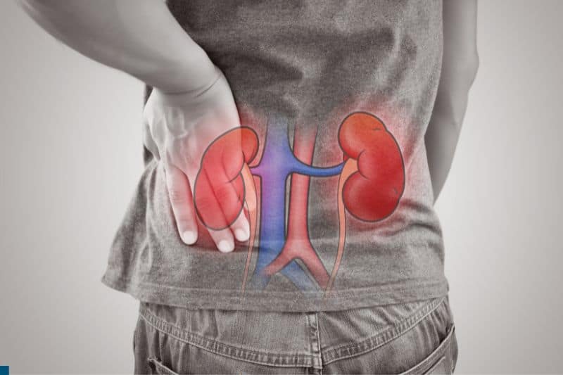 How Much Does a Kidney Weigh Your Guide to Kidney Measuringly