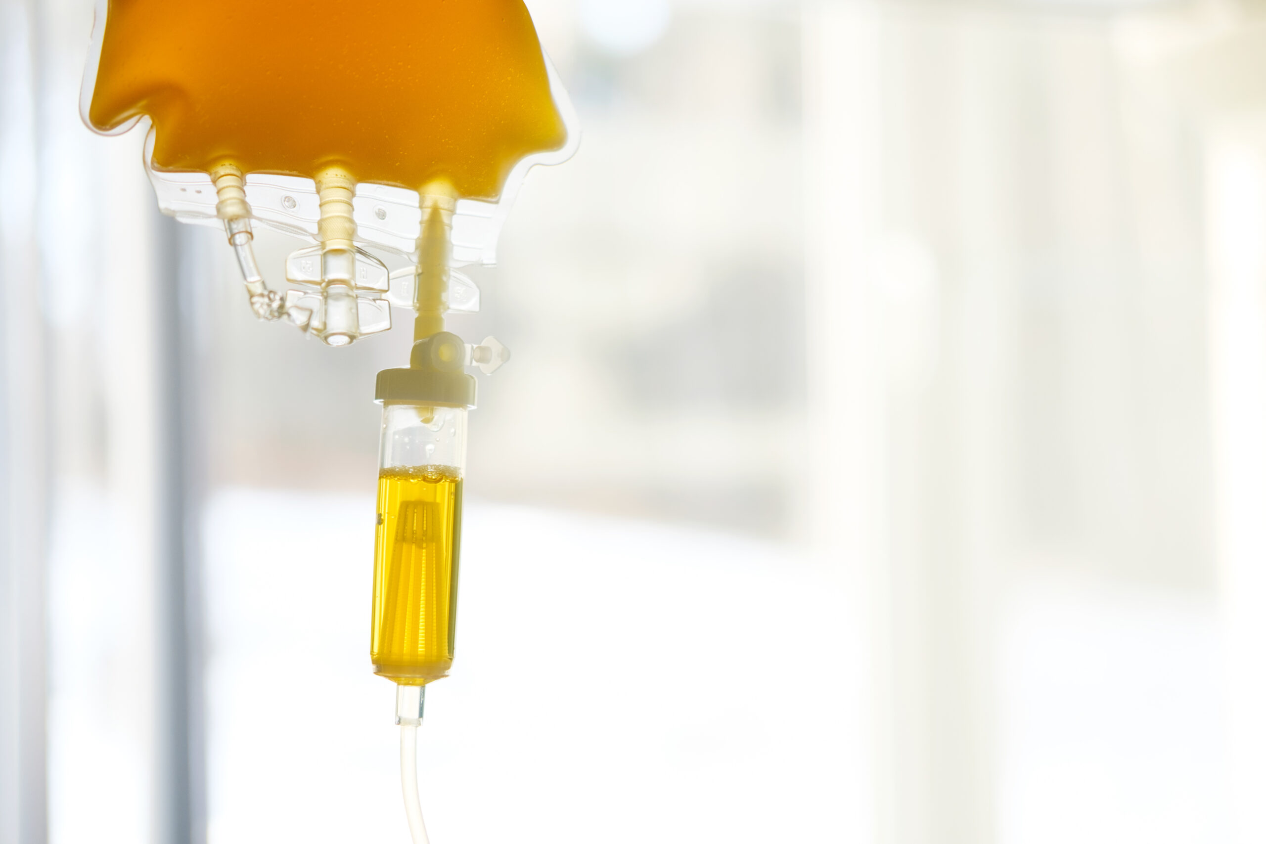 Vitamin and Mineral Supplementation for Alcohol Withdrawal PLEASE