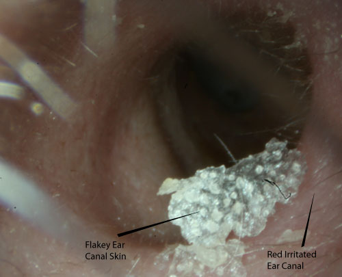 Itchy Ears | Mcgovern Medical School
