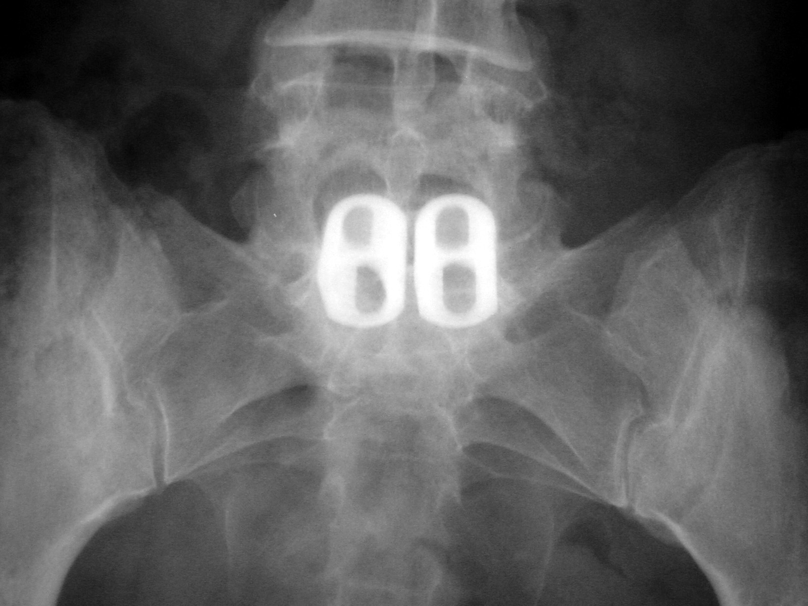 Neck and Spine Medical Apparatus a gallery