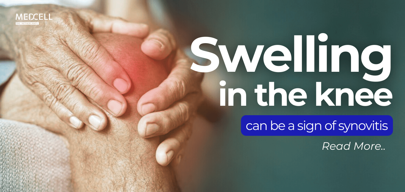 Signs And Symptoms Of Synovitis (Knee Joint) OVOJOINT Medcell Pharma