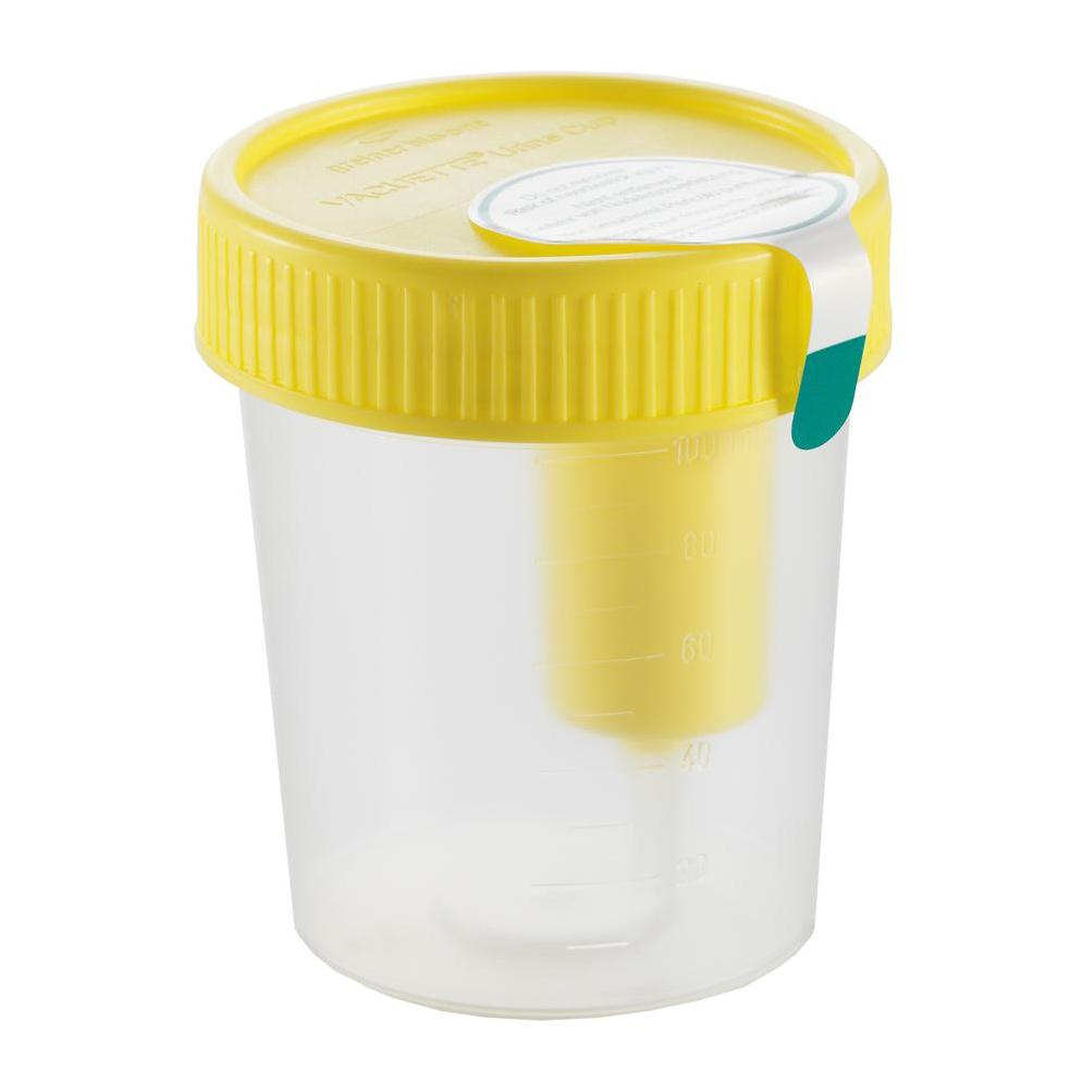 BD Vacutainer® Urine Cup with Integrated Transfer Device