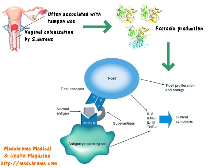 Toxic Shock Syndrome Pathogenesis