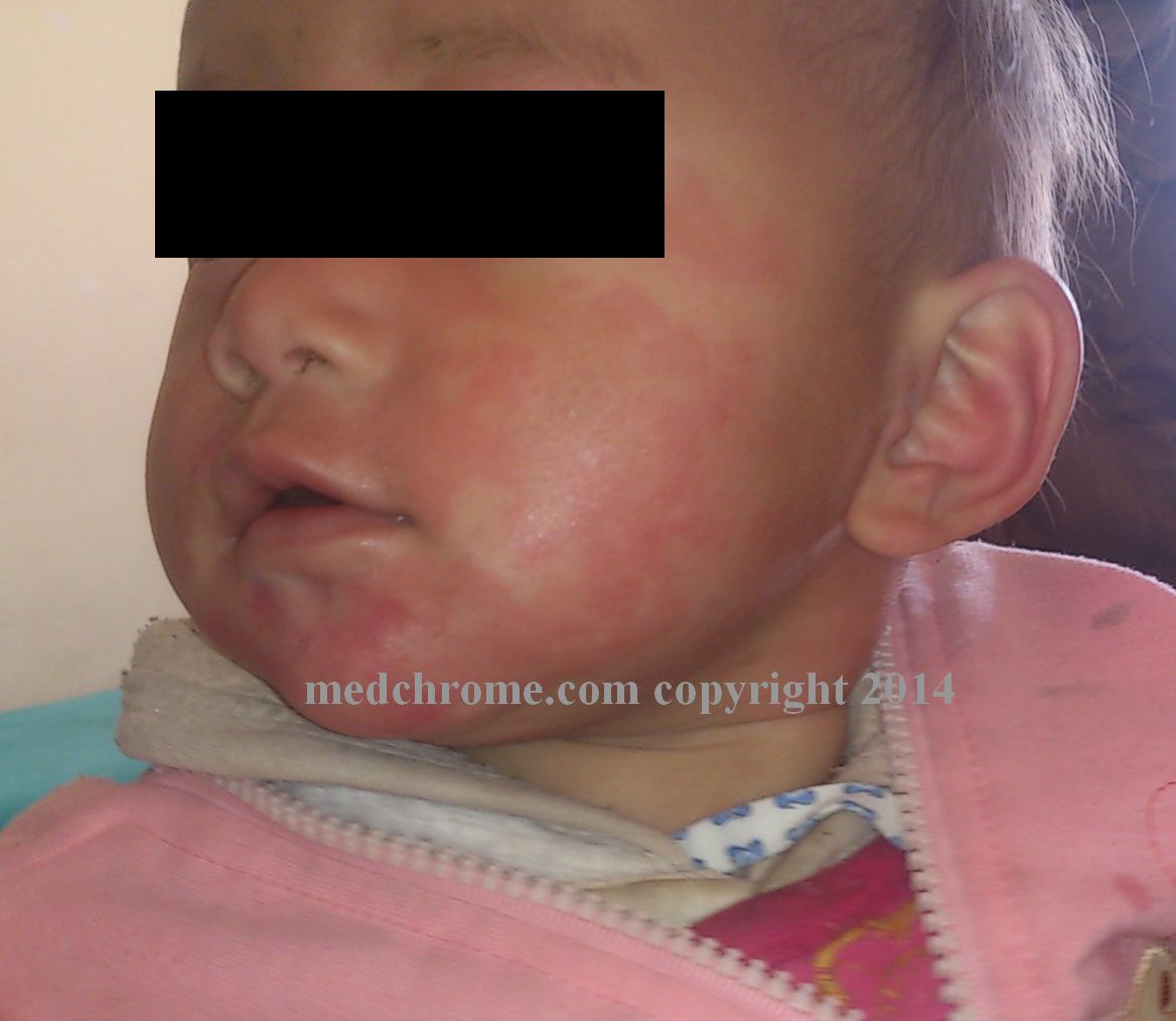 Interesting medical cases Spot diagnosis Medchrome