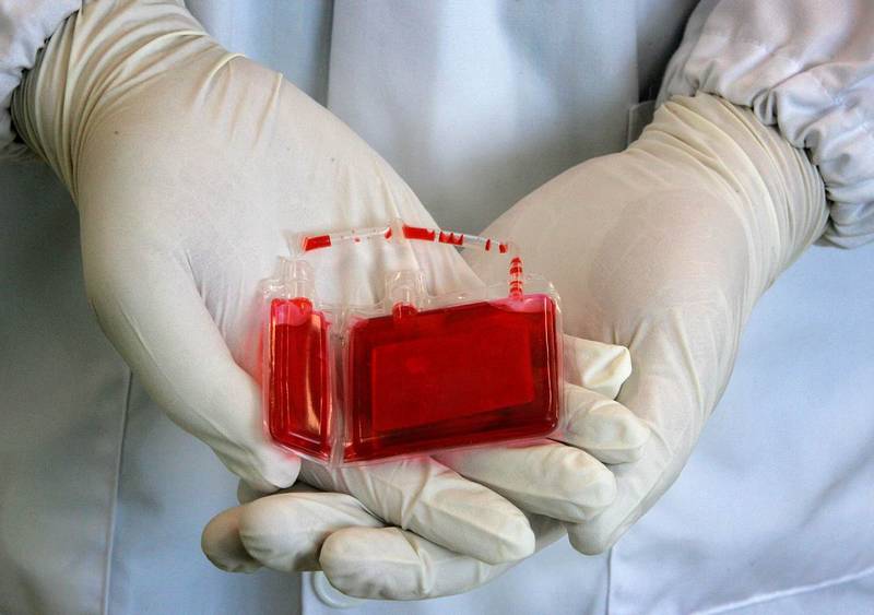 Family Cord Blood Banking – Parents’ Guide to Cord Blood