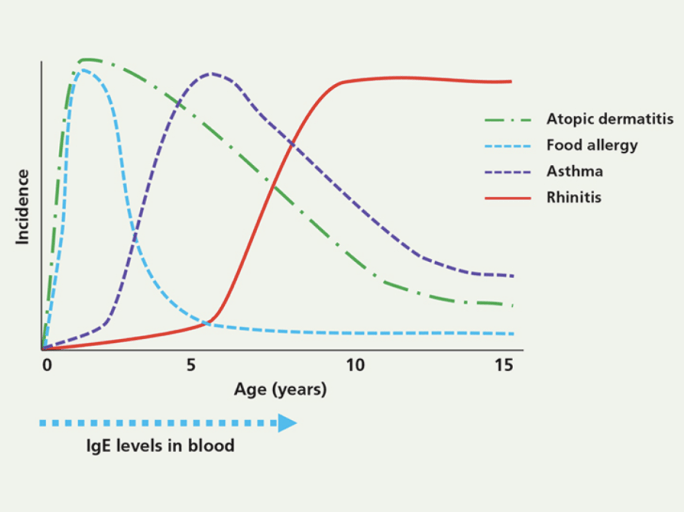 allergy test for kids, allergy test for babies, baby allergy testing