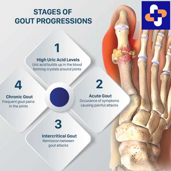 Gout of the Knee MedEd Cases(03)