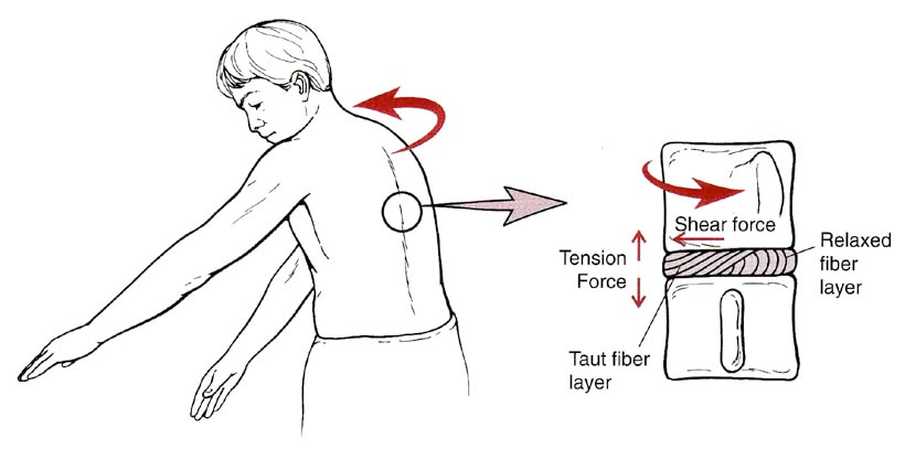 The Lumbar Spine Understanding the Science Behind Both