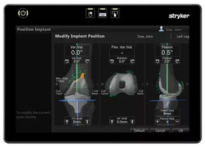 OrthoMap Software Stryker