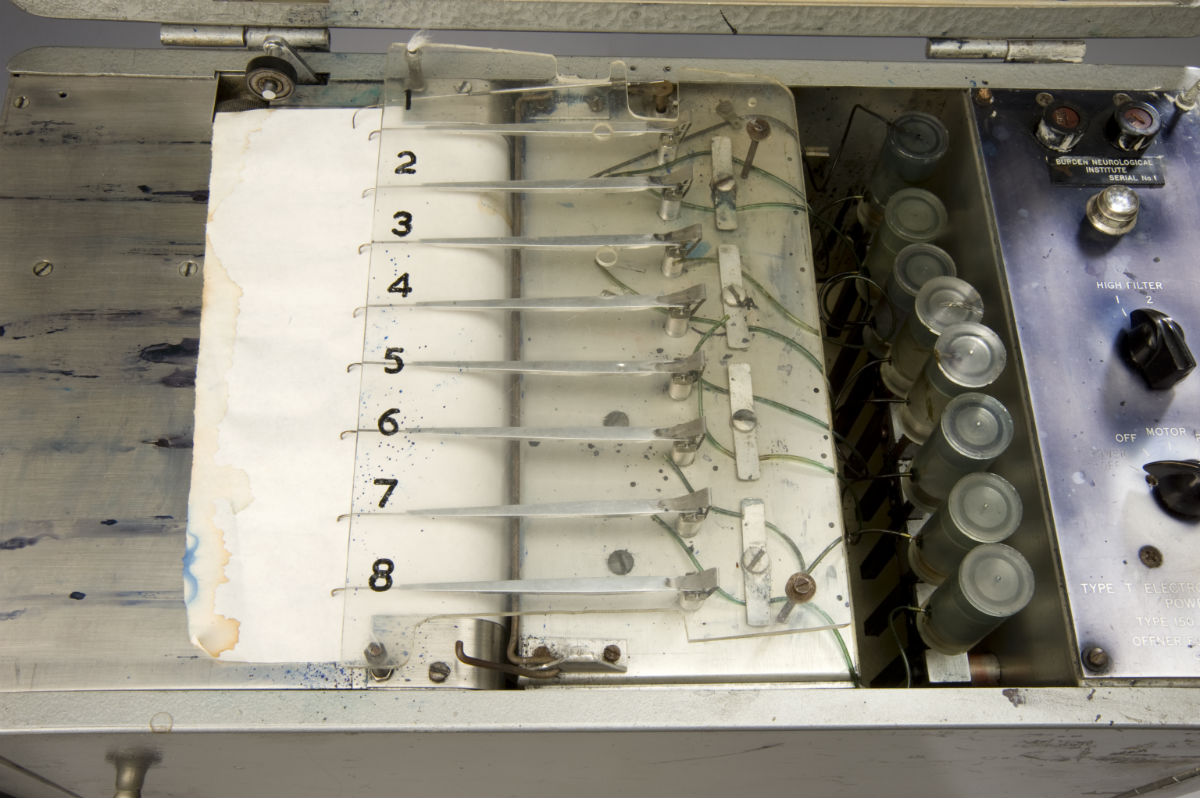 MedTech Memoirs The Electroencephalograph (EEG) Medical Design and
