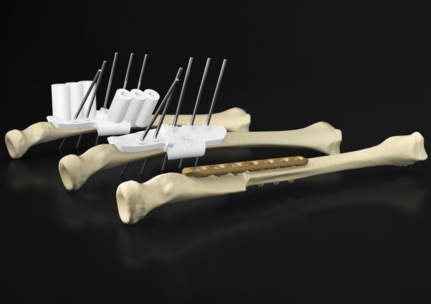 Fit To Print The Future Of Orthopedic Surgery Will Come Out Of A 3D