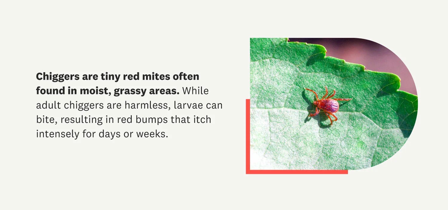 Ouch! How to Get Rid of Chiggers in Your Yard and Home