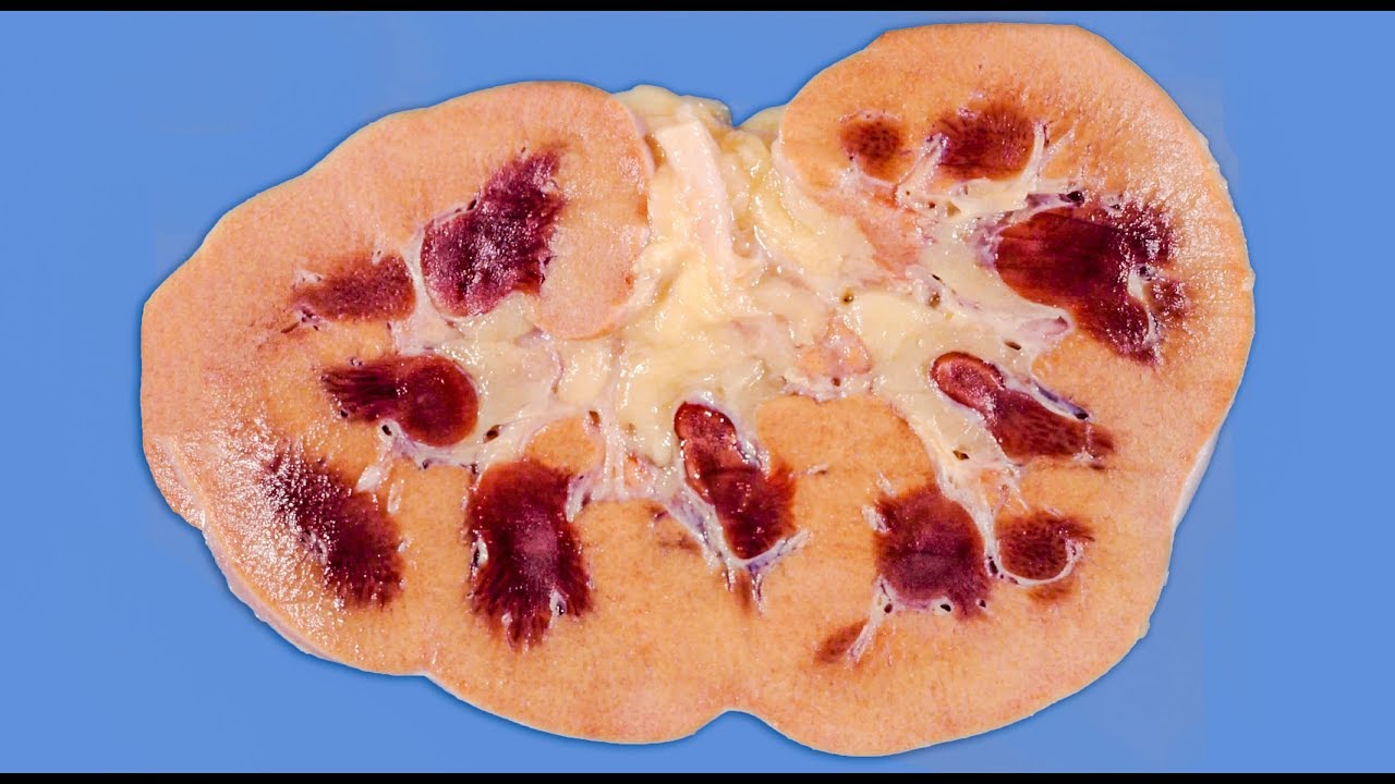 Gripping tale of what happened to the kidneys of a boy who