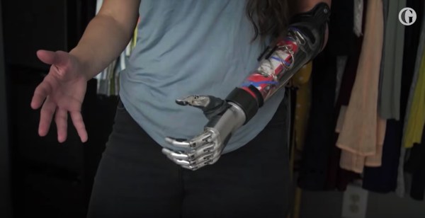 beyond-bionics-01.jpeg?fit=600%2C308&ssl