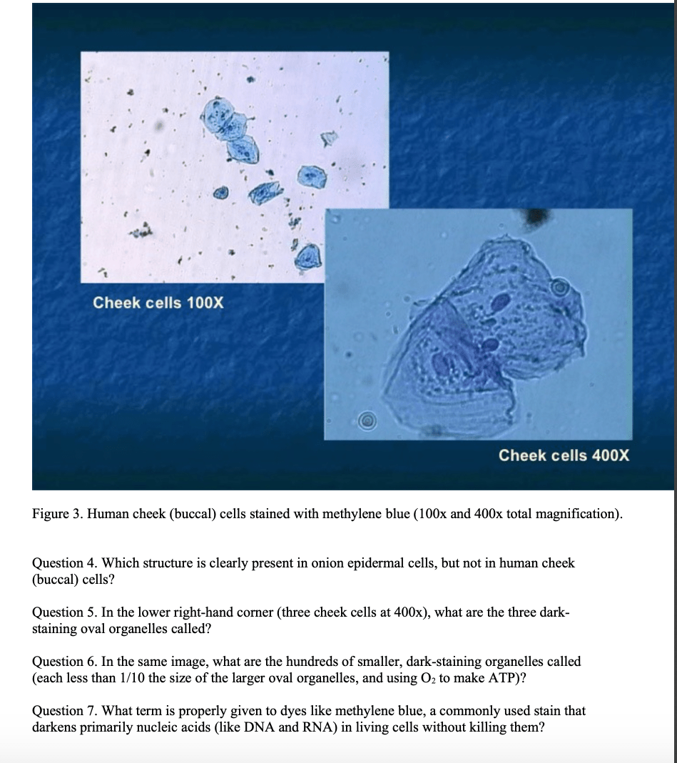 Solved Cheek cells 100X Cheek cells 400X Figure 3. Human