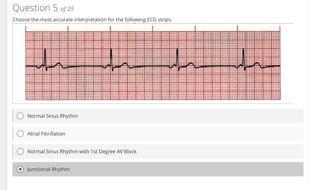 Solved Junctional Rhythm Normal Sinus Rhythm with PVCs