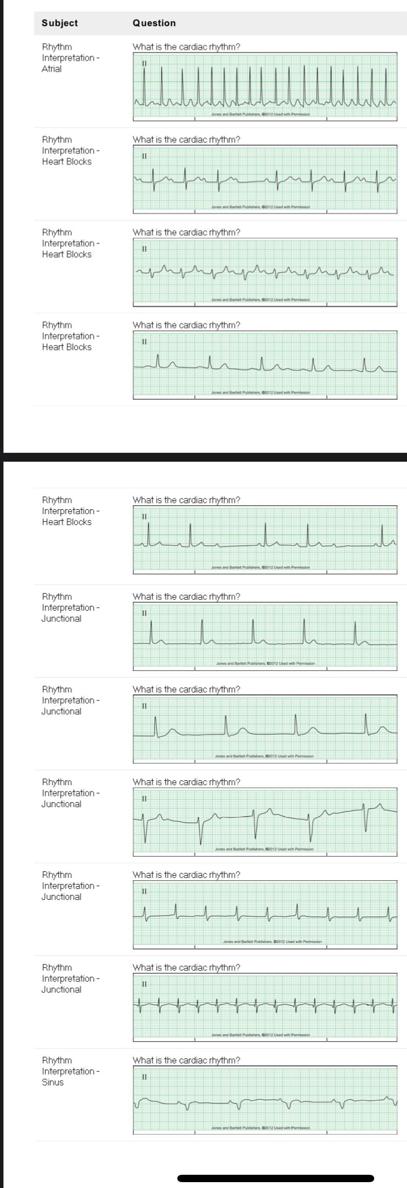 Solved What is the cardiac rhythm? What is the cardiac | Chegg.com