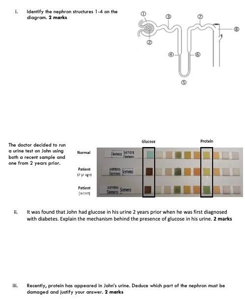 Solved 1. Identify the nephron structures 1-4 on the | Chegg.com