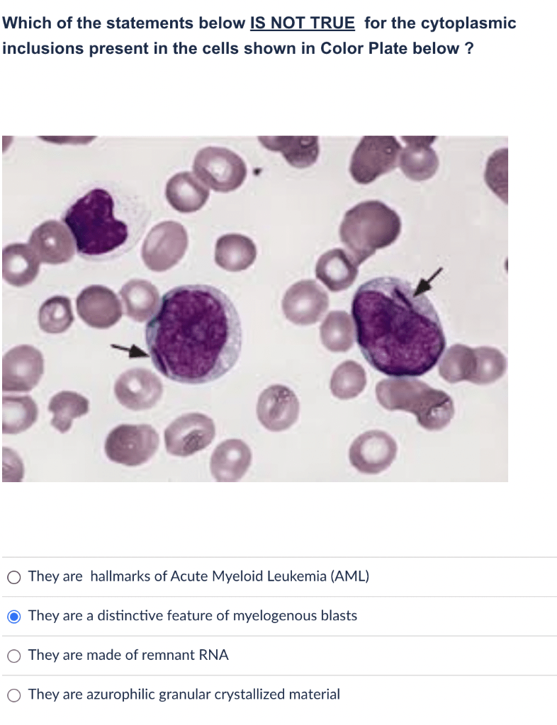 Solved Which of the statements below IS NOT TRUE for the