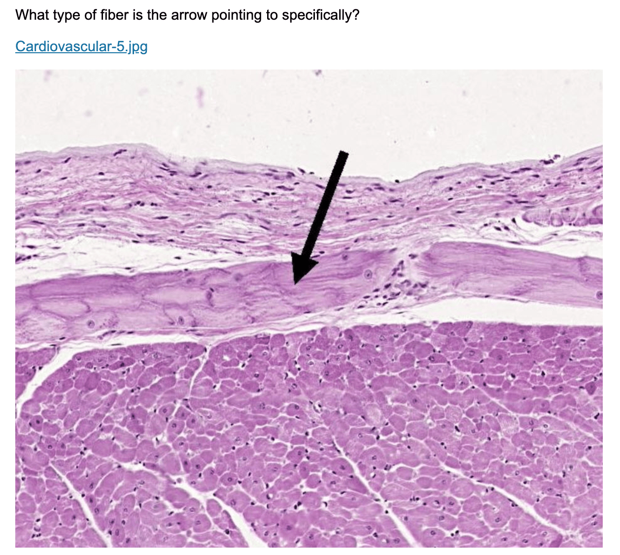 Solved What type of fiber is the arrow pointing to