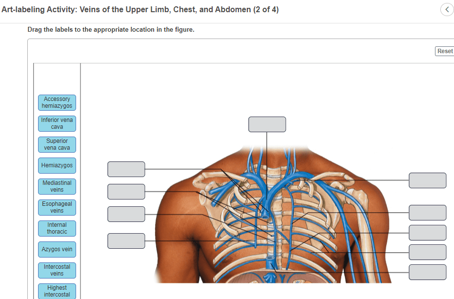 Solved Artlabeling Activity Arteries of the Chest and